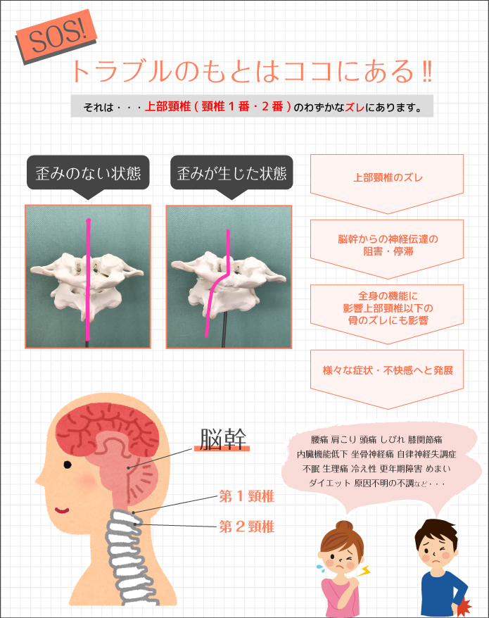 SOS!　トラブルのもとはココにある!!　それは・・・上部頸椎(頸椎1番・2番)のわずかなズレにあります。歪みのない状態　歪みが生じた状態　上部頸椎のズレ→脳幹からの神経伝達の阻害・停滞→全身の機能に影響上部頸椎以下の骨のズレにも影響→様々な症状・不快感へと発展→腰痛 肩こり 頭痛 しびれ 膝関節痛内臓機能低下 坐骨神経痛 自律神経失調症不眠 生理痛 冷え性 更年期障害 めまいダイエット 原因不明の不調など・・・　脳幹　第1頸椎　第2頸椎